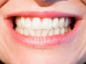 teeth-1652976_960_720.jpg